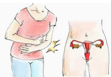 成都宫颈疾病为什么会影响