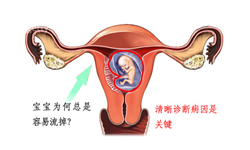 习惯性流产可以再怀孕吗?